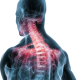 chiropractic clinic Sioux Falls, stretches for your back, when to go to a chiropractor, chiropractor Sioux Falls